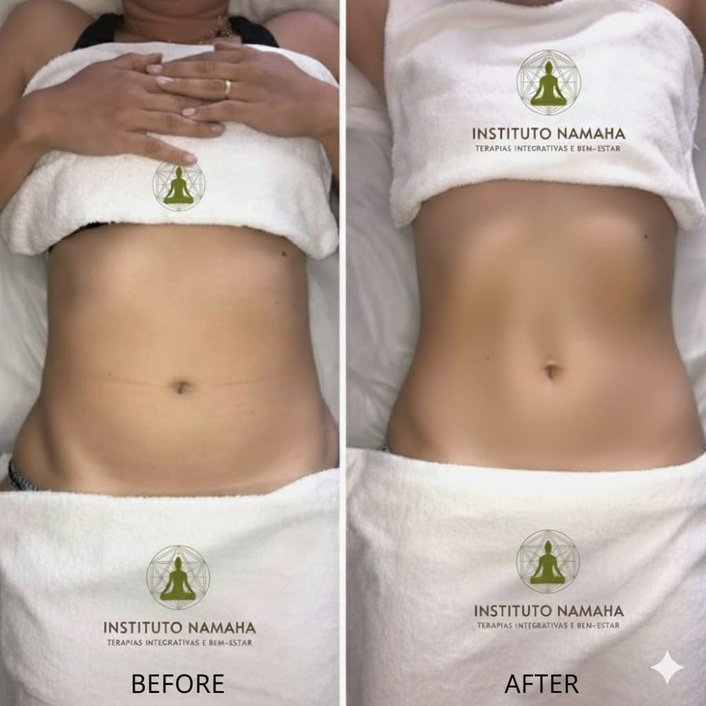 Protocolo Seca Barriga
