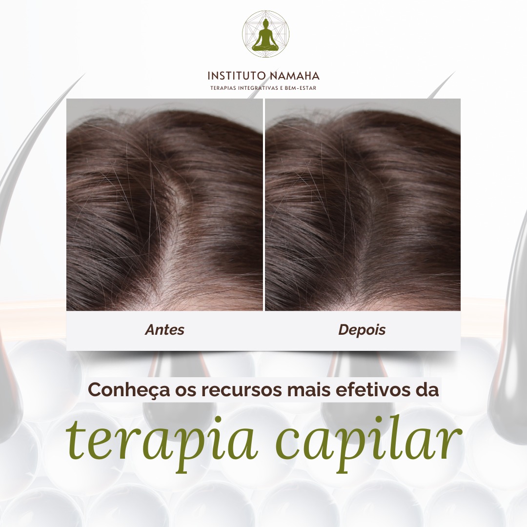 Terapia Capilar Feminina